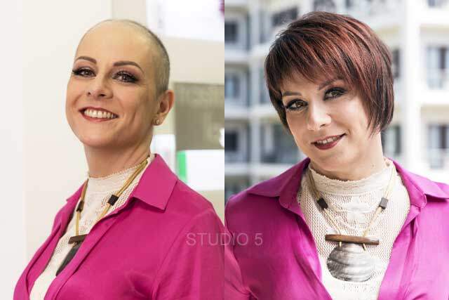 womens non-surgical hair replacement mechanicsville maryland