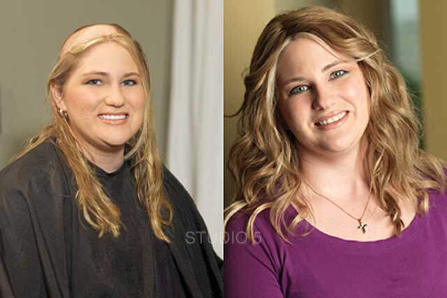 Women's Hair Restoration Baltimore Annapolis Pax River Maryland