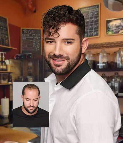 Custom Hair Replacement for Men Maryland Washington DC Virginia