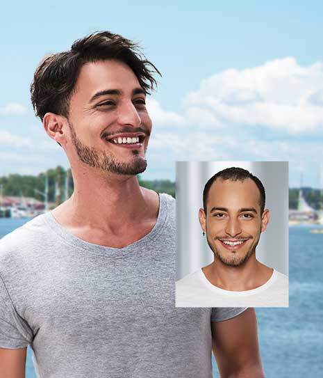 hair replacement st marys county maryland mens hair replacement st. mary's county maryland