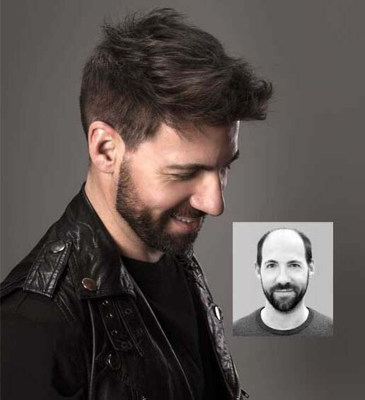 mens hair replacement restoration charles county maryland mens hair replacement restoration charles county maryland
